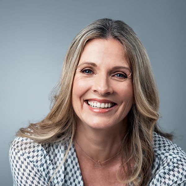 A mature woman smiling with her dental crowns