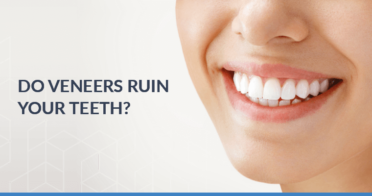 Do veneers ruin your teeth?